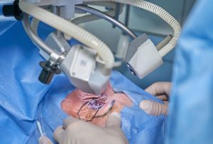 Operasi Lasik Mata Untuk Memperbaiki Masalah Penglihatan